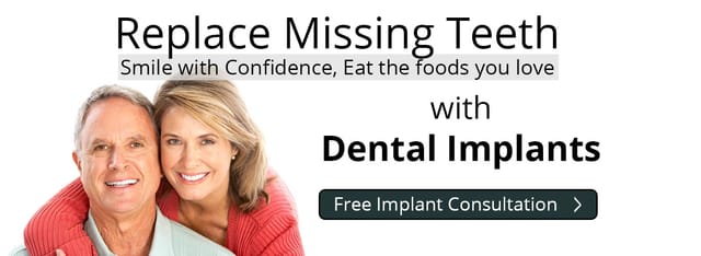 implant special overview slide5