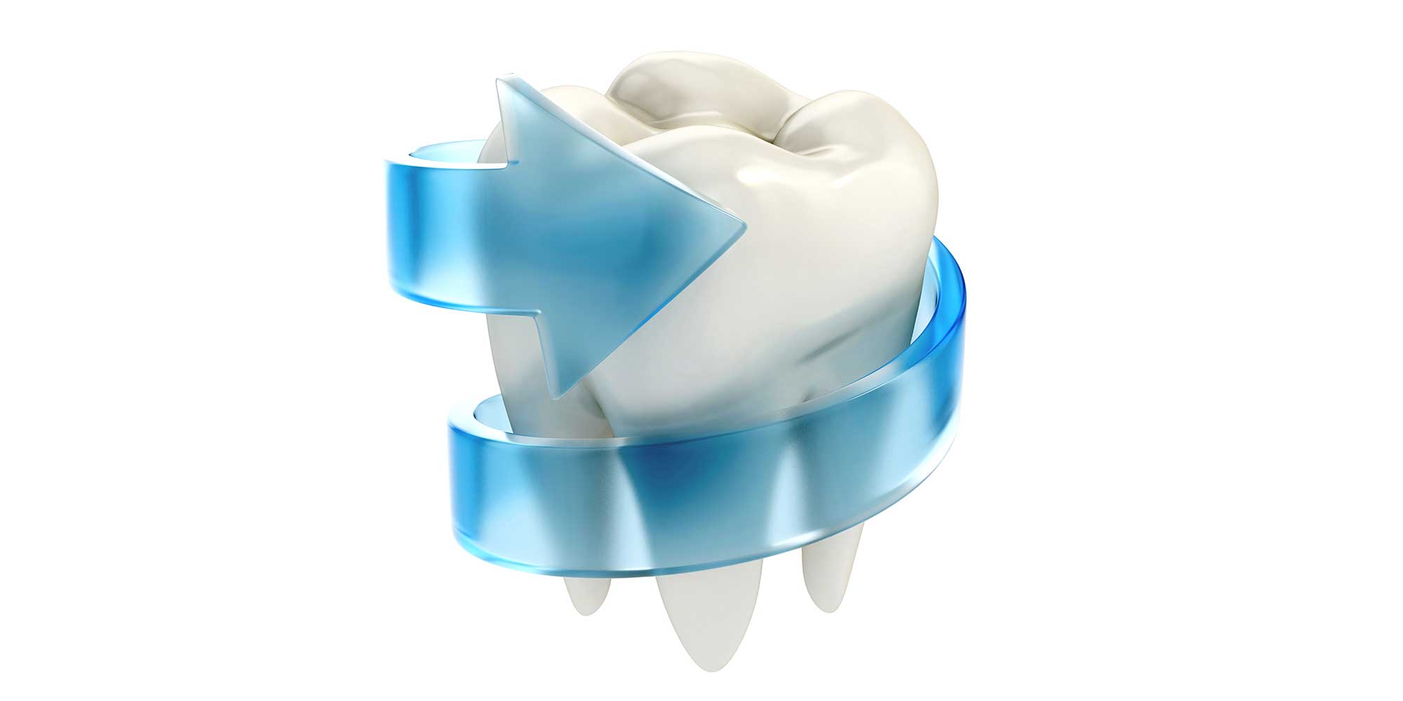 Dental Sealants Glendale Dental Arts