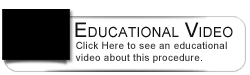 Dental Education Video - Single Visit Teeht Whitening